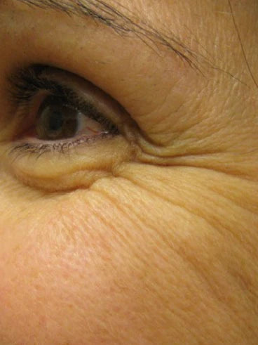 Before image for Melinda K.