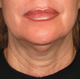 Before image for Julia K.