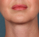 After image for Anna M.
