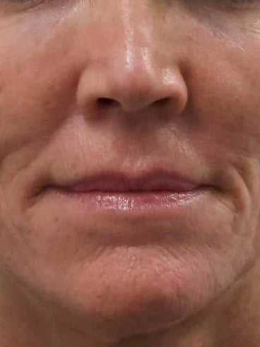 Before image for Anna M.