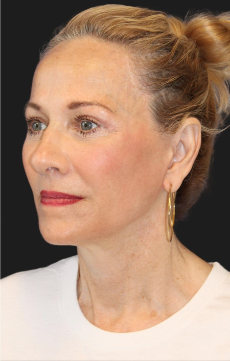 After image for SARAH H.